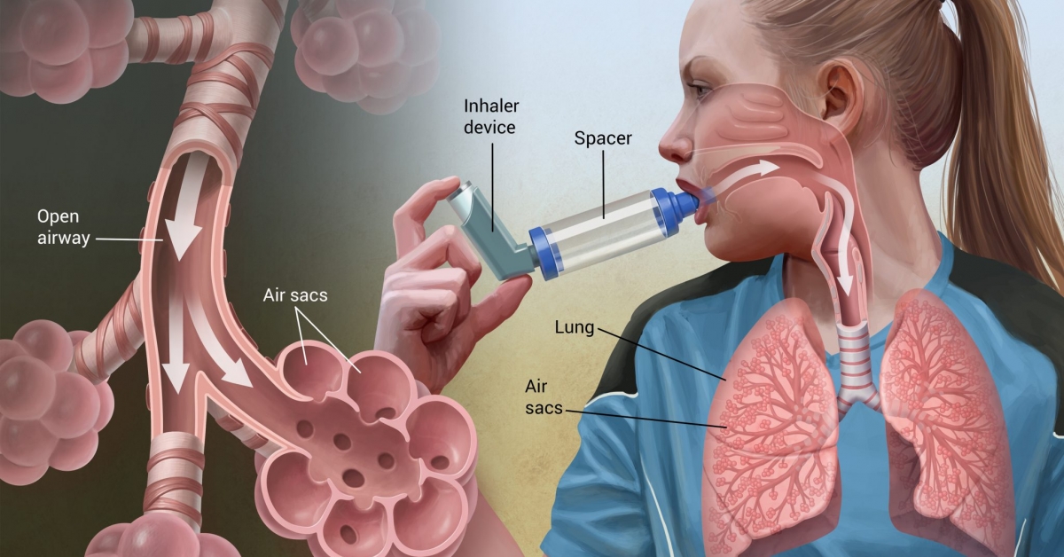 Astma aanval